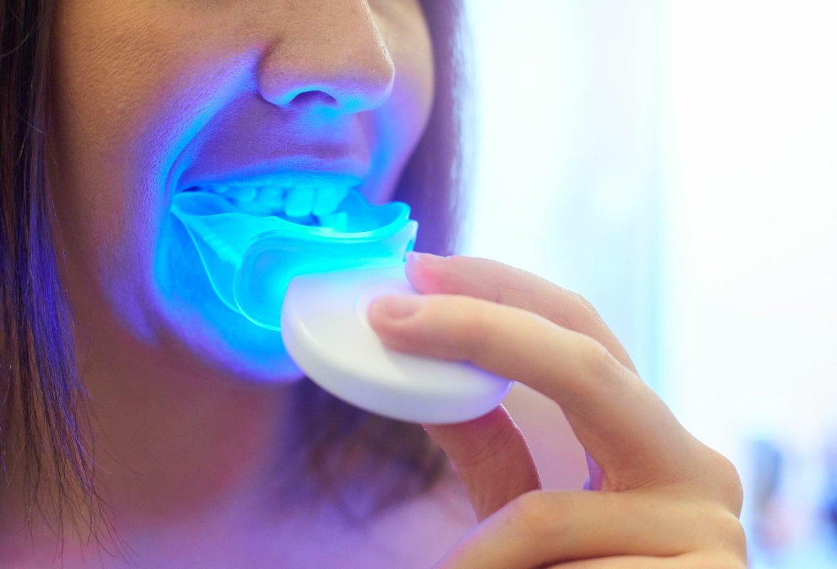 BLANQUEADOR DENTAL KIT COMPLETO